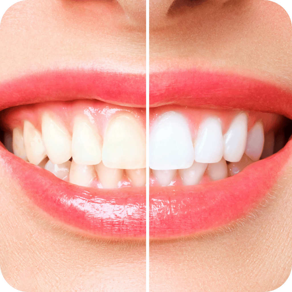 Jay Smiles Dental Clinic Services 1