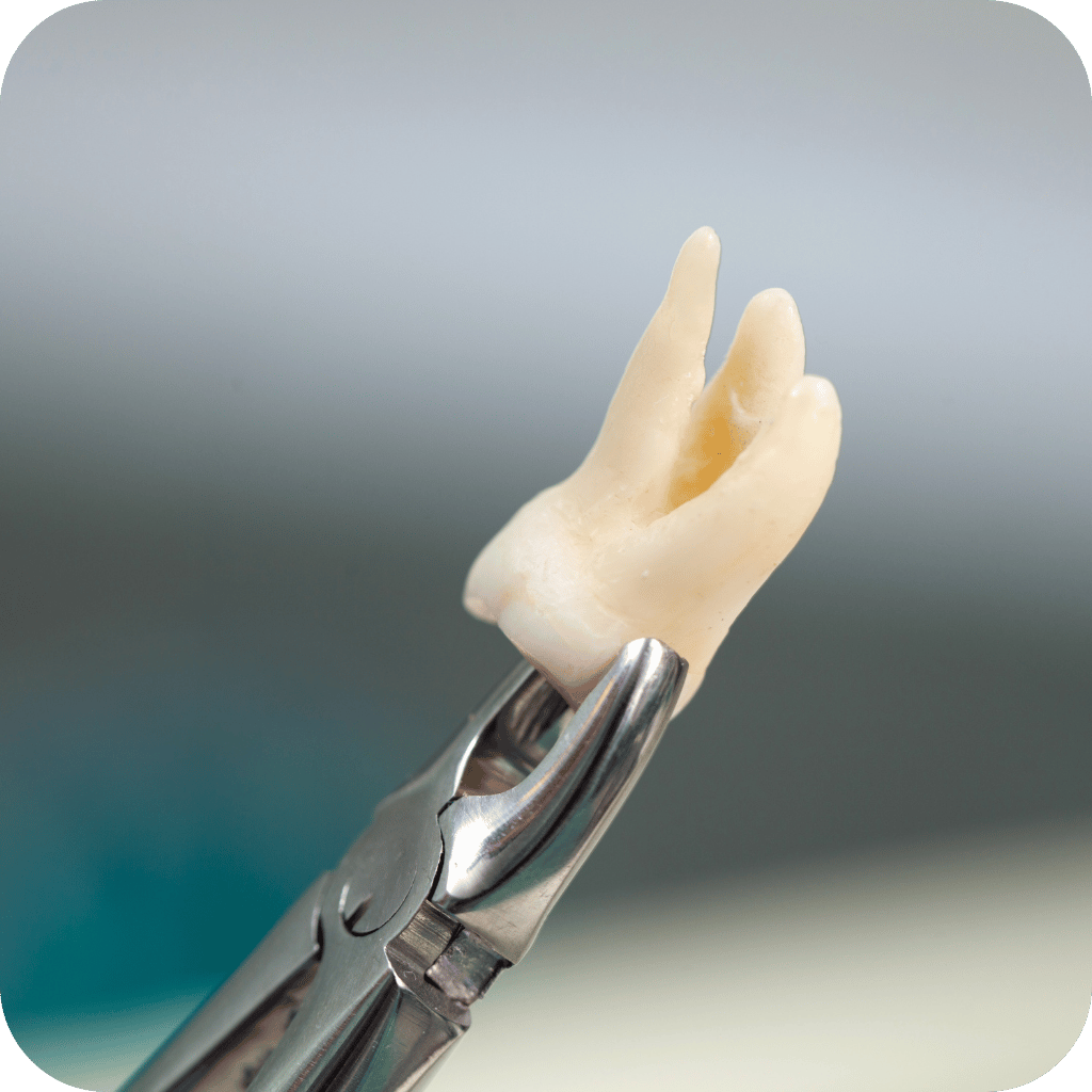 Jay Smiles Dental Clinic Services 11