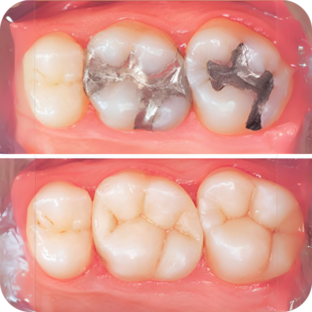 Jay Smiles Dental Clinic Services 12C