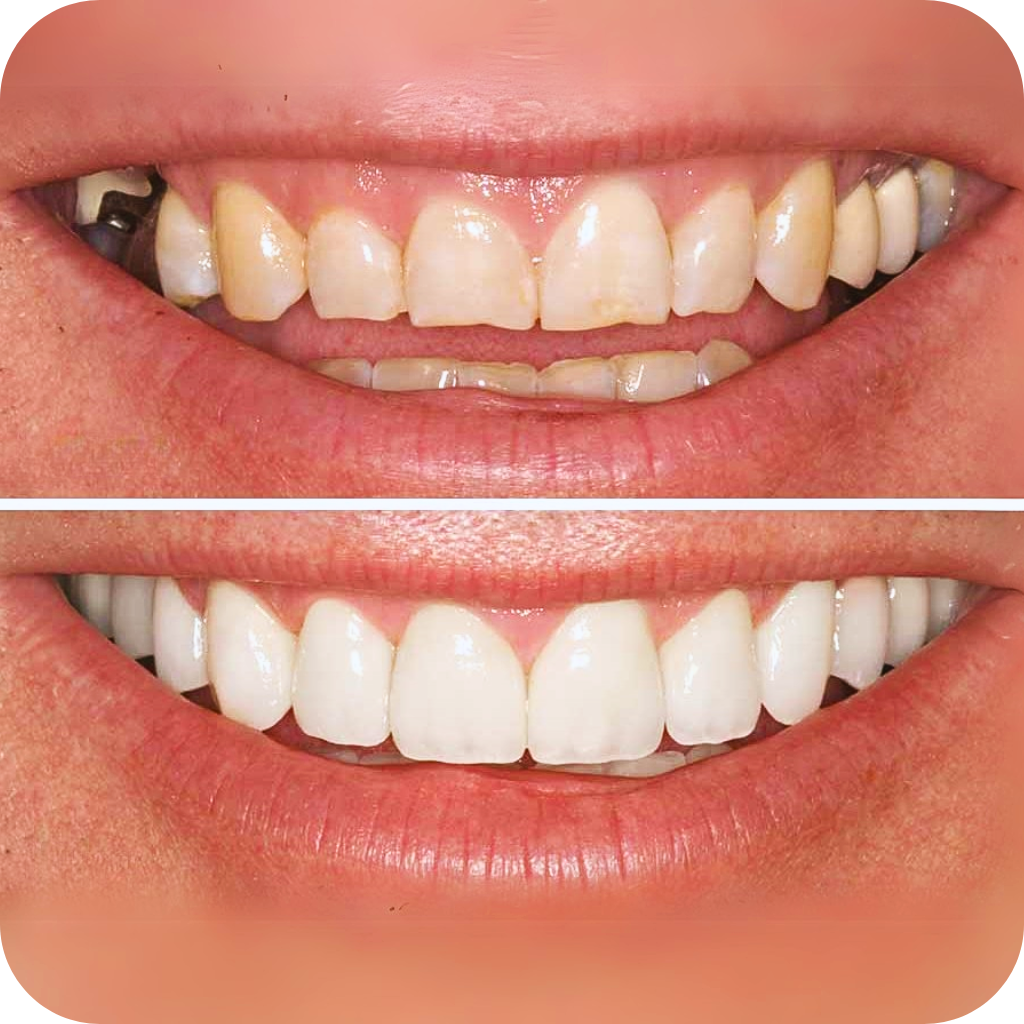 Jay Smiles Dental Clinic Services 2C