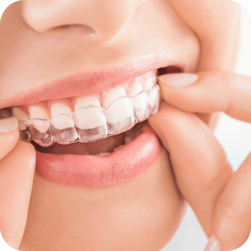 Jay Smiles Dental Clinic Services 6