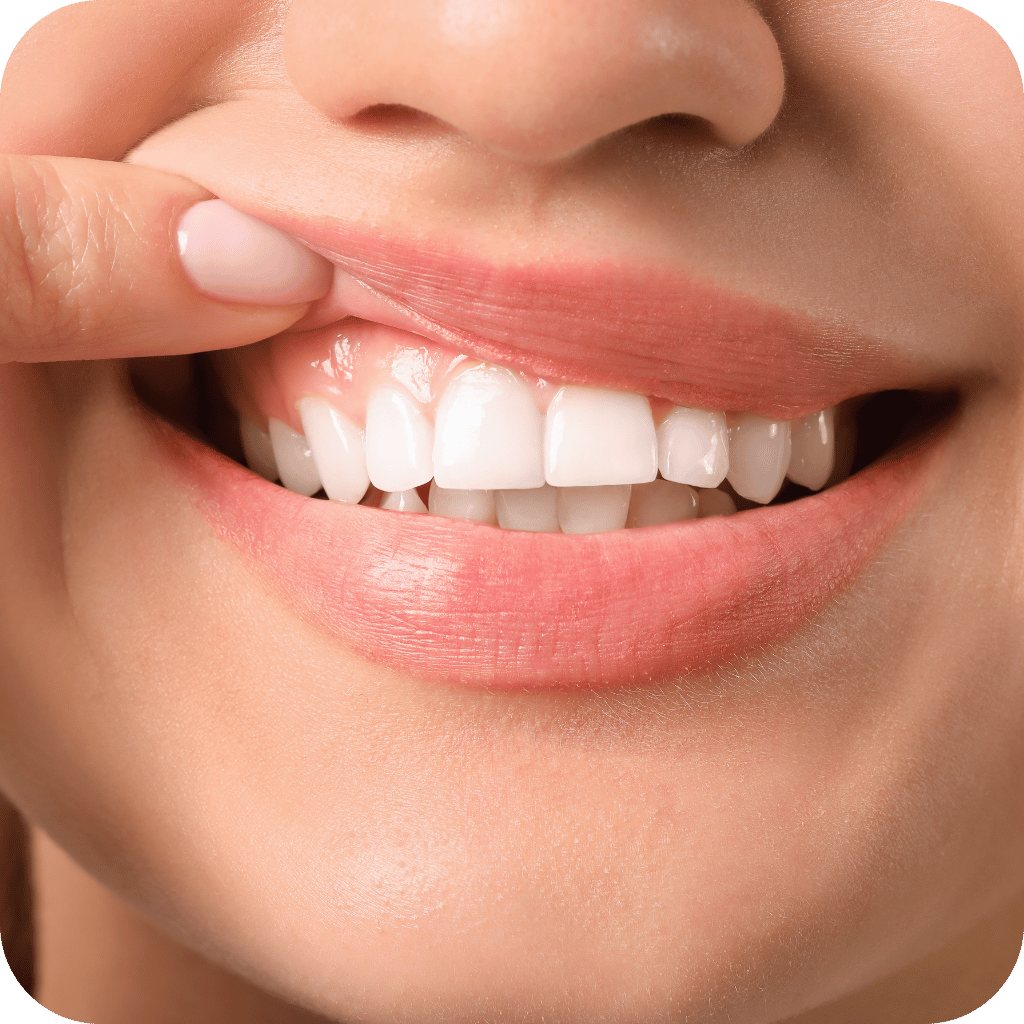 Jay Smiles Dental Clinic Services 7
